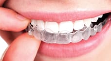 woman wearing brace